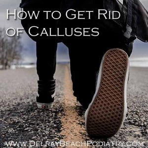 How to get rid of calluses (www.DelrayBeachPodiatry.com)