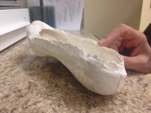 A plaster mold of a patient's foot to be used for the creation of a custom orthotic. 