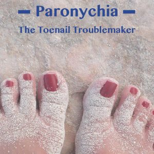 Paronychia: The Toenail Troublemaker
