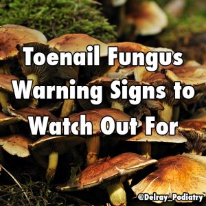 Keep an eye out for these toenail fungus warning signs.