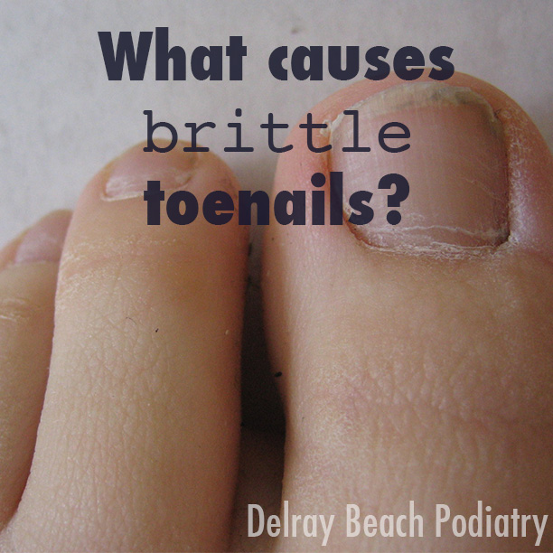 What causes brittle toenails? - Delray Beach Podiatry