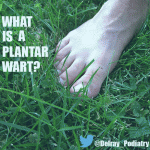 What is a plantar wart?