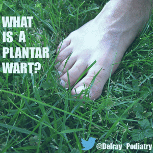 What is a plantar wart? [www.DelrayBeachPodiatry.com]