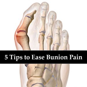 5 Tips to Ease Bunion Pain (Wikimedia Commons)