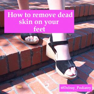 How to remove dead skin on your feet!